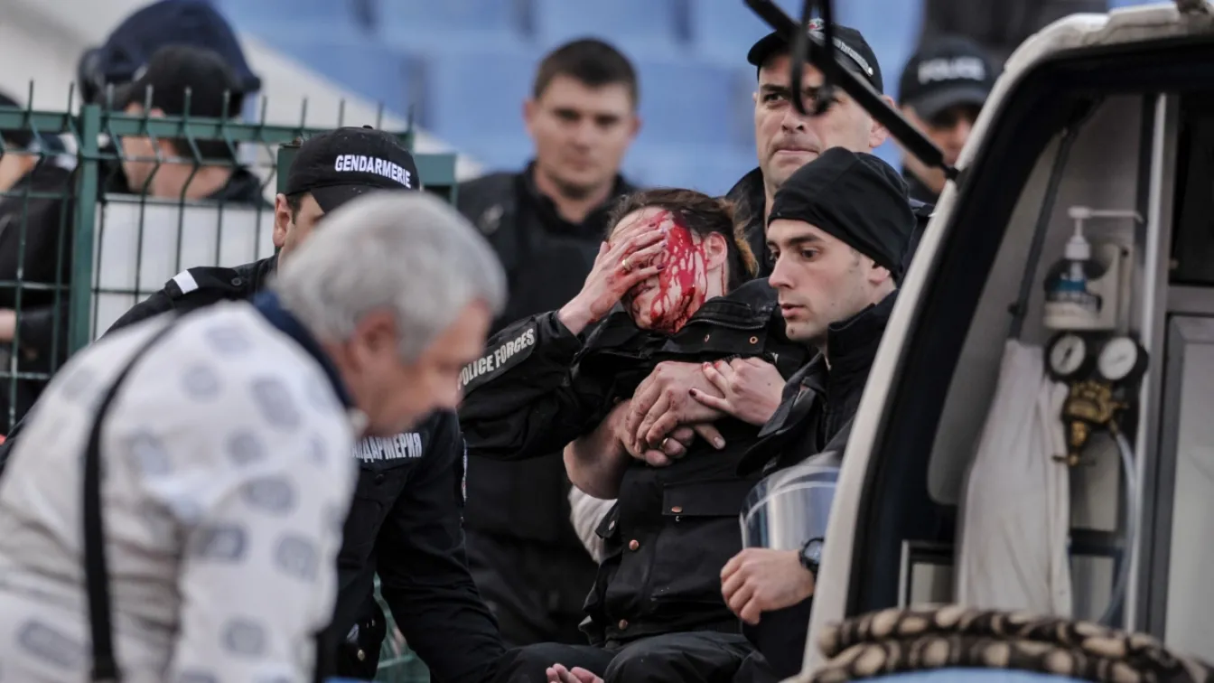 Полицайка с опасност за зрението след бомбичка на ЦСКА - 