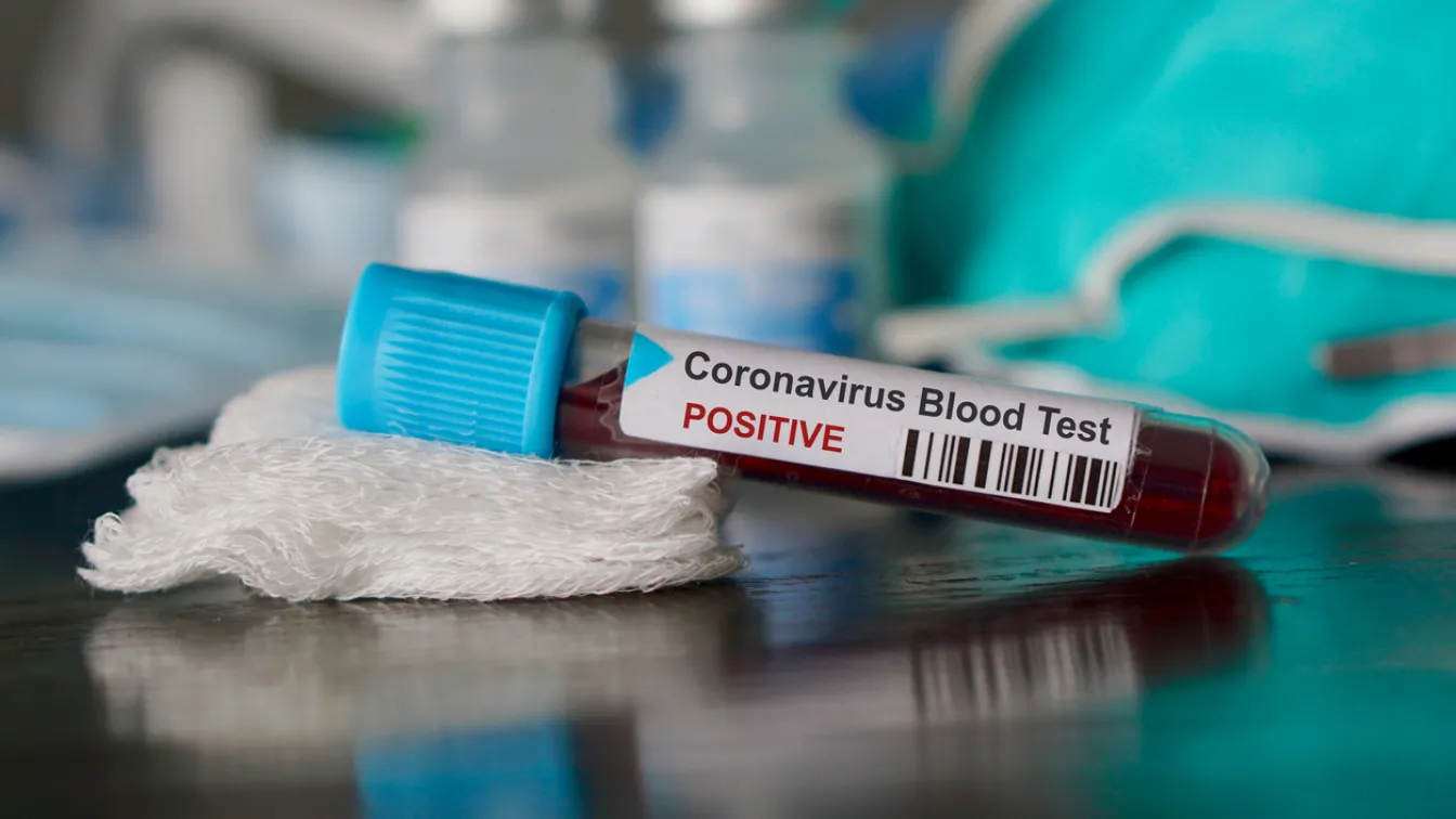Франция отчете рекорден брой заразени с COVID-19 за ден