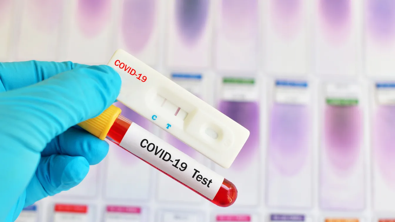 Испания ще изисква отрицателни PCR тестове за пристигащите от рискови страни