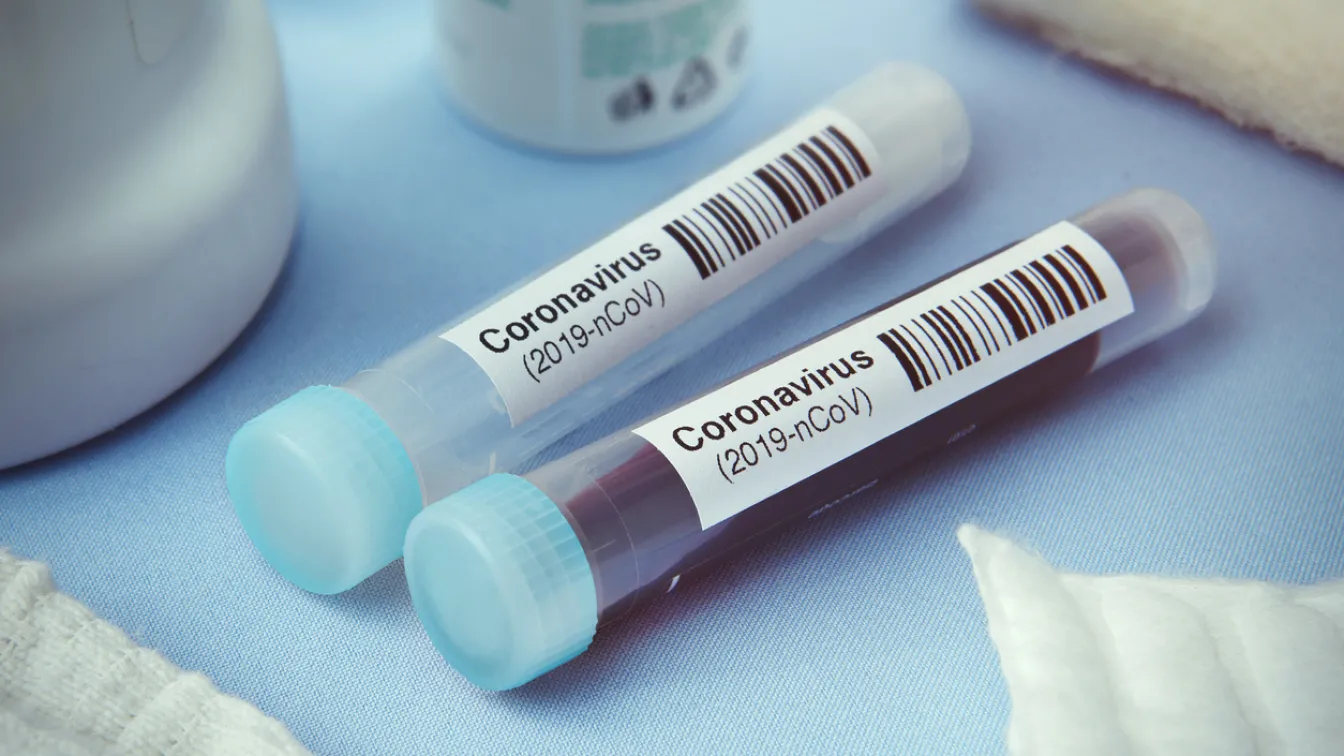 Първи смъртен случай от COVID-19 в Гърция