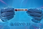 93 са новите случаи на COVID-19 у нас