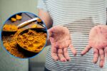 Лечение на лупус: 6 естествени начина за облекчаване на симптомите