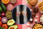 Ултрапреработените храни повишават риска от остеоартрит