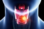 Изкуствен интелект диагностицира рак на гърлото от гласово съобщение