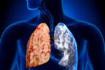 Каква е причината за рака на белия дроб при непушачи?