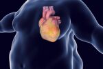 Мазнини около сърцето увеличават риска от инфаркт и инсулт