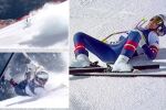 Линдзи Вон в интензивното след втора операция!