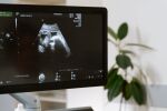 Нов AI ехограф за бременни открива до 84% от вродените аномалии