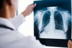 Изкуствен интелект помага на лекари да откриват белодробни заболявания
