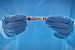 Нови 8 случая на коронавирус, общо болните от COVID-19 са 31 