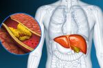 Откриват нов начина за лечение на холестерол и омазнен черен дроб