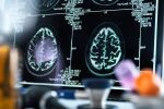 Ограничете тази хранa, за да намалите риска от инсулт