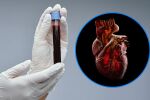 Кръвният тест, който предсказва инфаркт: Оказва се, че не е холестеролът