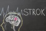Риск от повторен инсулт: Как да се предпазим