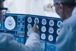 Генетичният риск от инсулт може да се изчисли с AI, сочи проучване