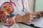 5 причини, че бъбреците не функционират правилно според нефролог