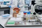Случаите на рак на простатата растат с 3% годишно