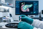 Кръвен тест за рак на панкреаса открива 87% от ранните случаи