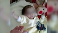 Разделянето на сиамските близнаци от Сливен – анатомично невъзможно