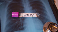 Няма ваксини и бързи тестове за метапневмовируса (HMPV)