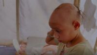 8-годишно момиче губи косата си от нервен срив: 