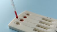 Рекордни нива на заразени от гонорея и сифилис в Европа. Какви са симптомите?