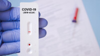 COVID сертификатите в ЕС: Приравниха бързите антигенни тестове на PCR изследванията