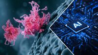 Само по селфи: Изкуствен интелект прогнозира шансовете за оцеляване на пациенти с рак