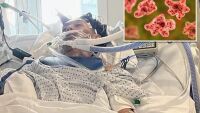 Втори случай за 10 дни: Тийнейджър почина от разяждаща мозъка амеба