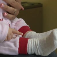 Взривът от морбили: Не са имунизирани близо 5900 деца на 13 месеца, които е трябвало да бъдат ваксинирани