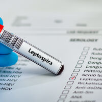 Случаи на заразени с лептоспироза на остров Закинтос, мъж е починал