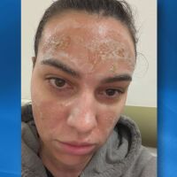 Отнета е регистрацията на салона, в който жена получи втора степен изгаряния