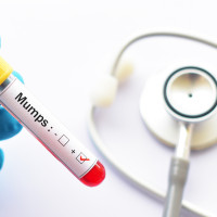 66 случая на морбили са регистрирани в страната