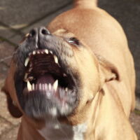 Питбул нападна стопанката си, наложи се ампутация на крака ѝ