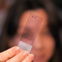 Има ли „лечебна“ диета при лупус?: Проучване на млад учен от БАН