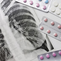 26 случая на туберкулоза са регистрирани до края на ноември в Пазарджишко