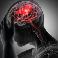 Учени: Децата на разведени родители са по-предразположени към инсулт 