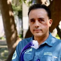 „Това животно ми пощади живота“: Биолог, ухапан от акула, се надява да я срещне отново