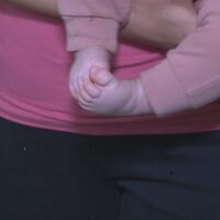 Спасителите на бебето с рекорден брой левкоцити: Нямахме нито право на грешки, нито време за губене