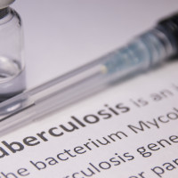 СЗО: Туберкулозата е убила 1,23 милиона души през изминалата година