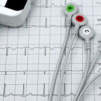 Защо случаите на инфаркт и инсулт се увеличават между Коледа и Нова година?