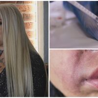 Дилъри на ботокс: Незаконна и опасна козметика от Азия залива българския пазар