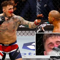 „Мускулите на окото не работят“: Световният шампион на UFC Том Аспинал „все още не вижда“ с дясното си око след бъркането