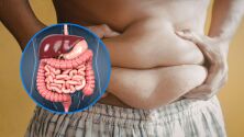 Защо не може да отслабнете: Има скрита причина и тя се крие в червата