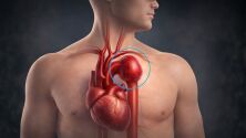 Гръдна аневризма: Защо млади и здрави хора умират внезапно