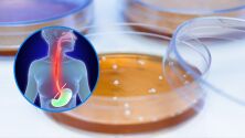  Как бактерията Lactobacillus може да предотврати рака