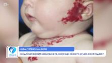 Инфантилен хемангиом: Какво се крие зад диагнозата? (ВИДЕО)