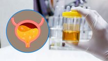 Как стресът влияе върху функцията на пикочния мехур?