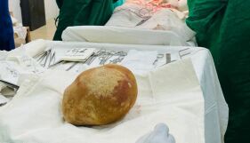 С теглото на новородено бебе и с размерите на щраусово яйце: Лекари извадиха 17-сантиметров камък от пикочния мехур на мъж (СНИМКИ)