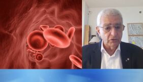 Проф. Набил Сейда: Една инжекция ще блокира PCSK9 за цял живот. Това ще намали холестерола и ще умори туморите от глад